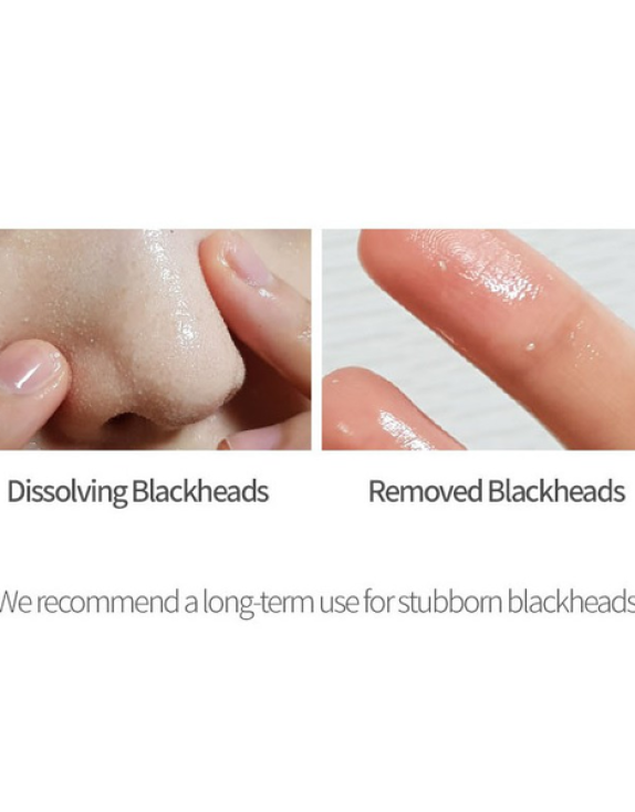 CELIMAX Derma Nature Fresh Blackhead Jojoba Cleansing Oil — Гідрофільна олія з олією жожоба для очищення пор і видалення чорних цяток, 150 мл