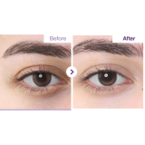 Numbuzin No.9 NAD Retinol Volumetox Eye Cream крем для шкіри навколо очей з ретинолом та NAD+, 10 мл