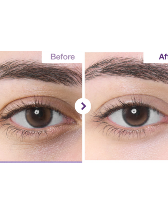 Numbuzin No.9 NAD Retinol Volumetox Eye Cream крем для шкіри навколо очей з ретинолом та NAD+, 10 мл